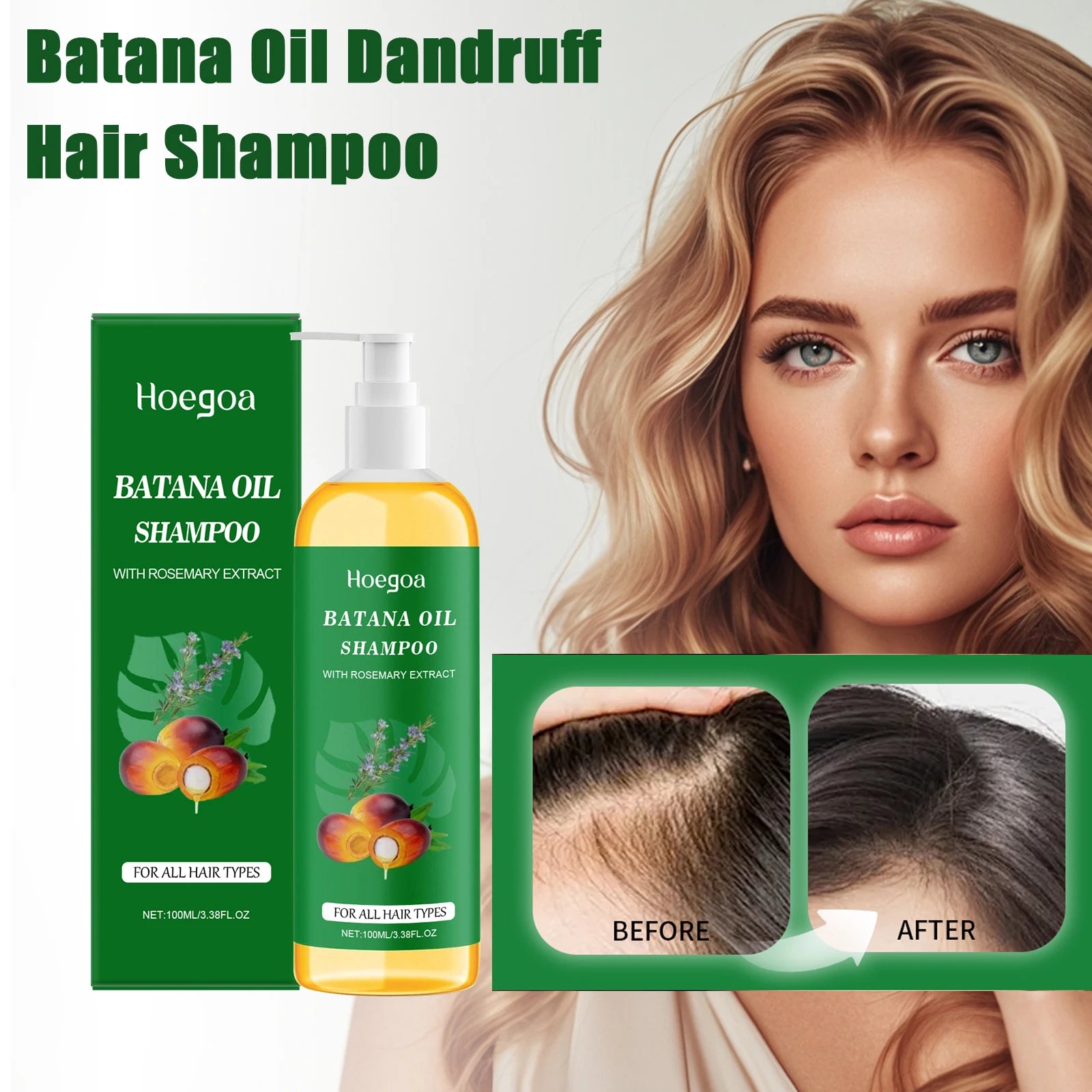 Batana Oil Hair Booster Shampoo – Oil Control & Dandruff Care