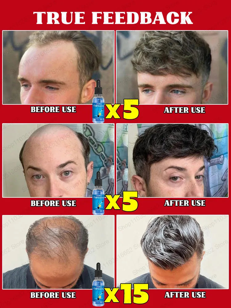 Hair Growth Treatment – Thickening & Anti-Baldness Solution