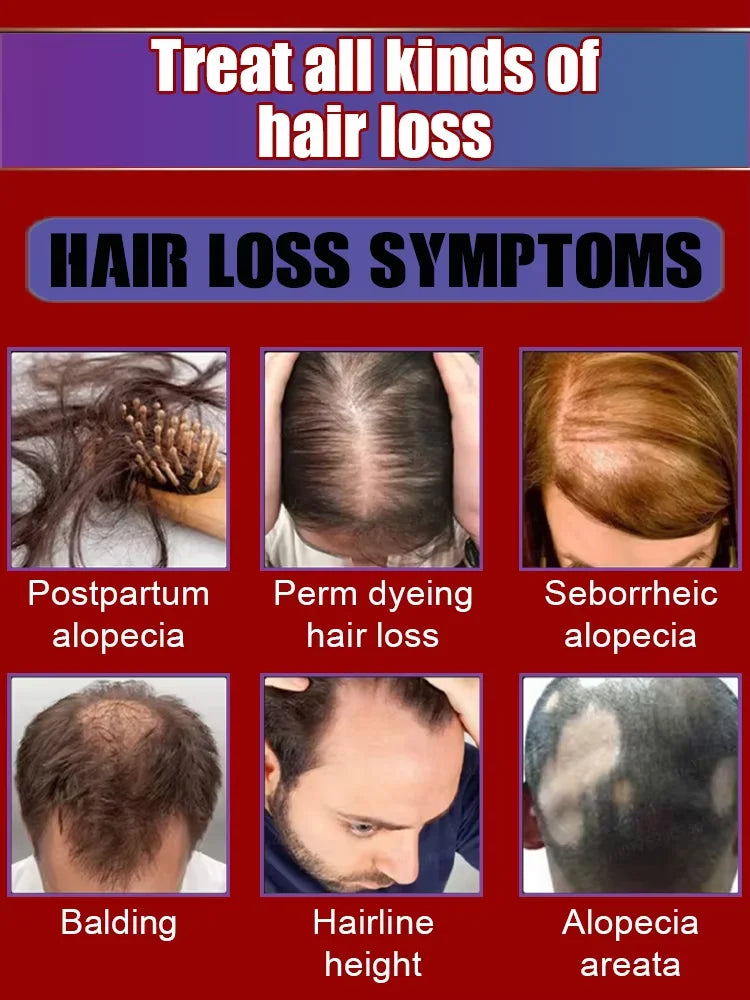 Hair Growth Treatment – Thickening & Anti-Baldness Solution