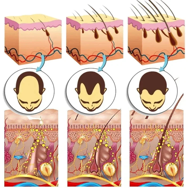 Ginger Hair Growth Serum – 7-Day Fast Hair Regrowth & Anti-Hair Loss