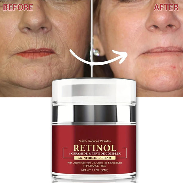 Instant Retinol Cream – Anti-Aging Wrinkle Remover & Firming