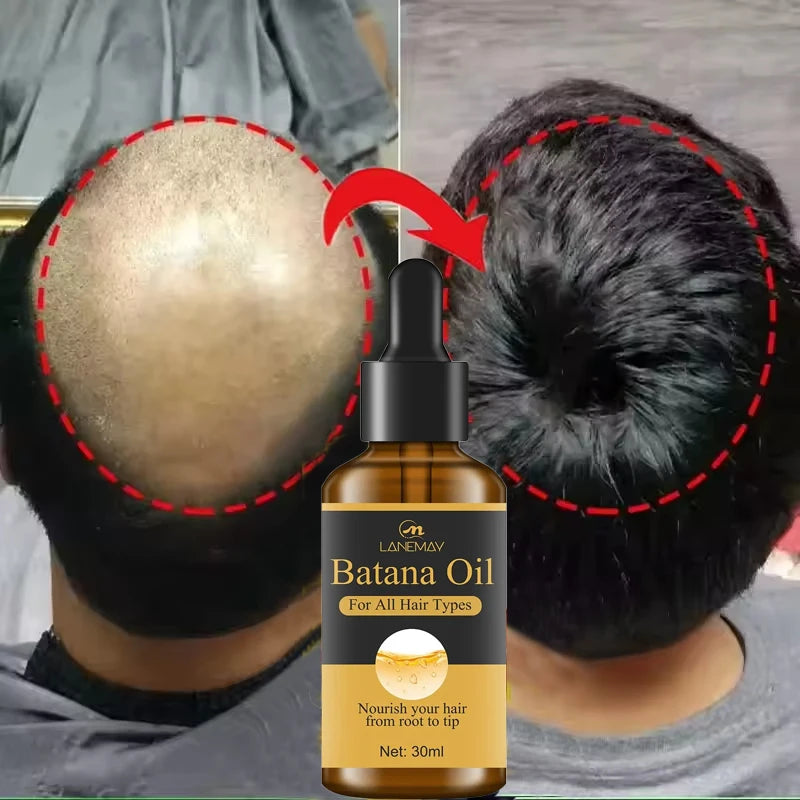 Batana Oil Hair Growth Serum – 7-Day Fast Regrowth & Repair