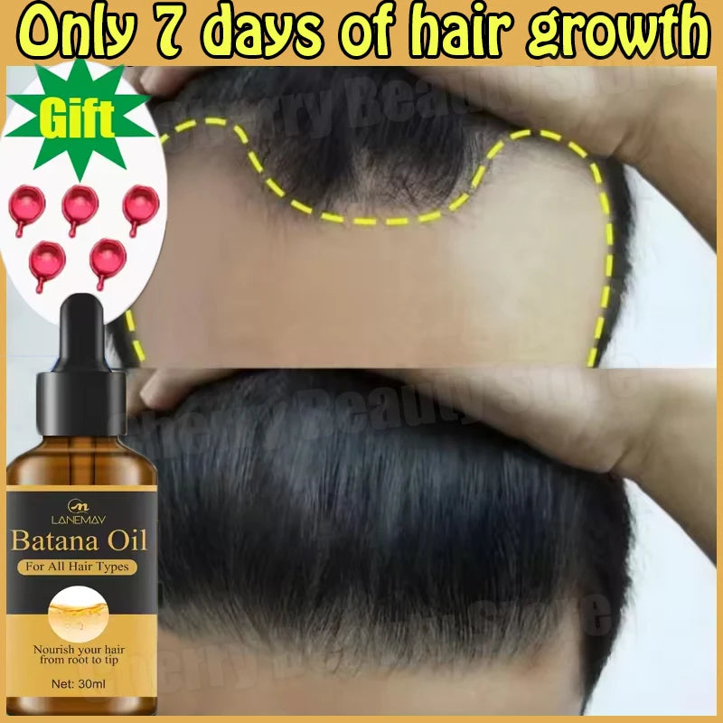 Batana Oil Hair Growth Serum – 7-Day Fast Regrowth & Repair