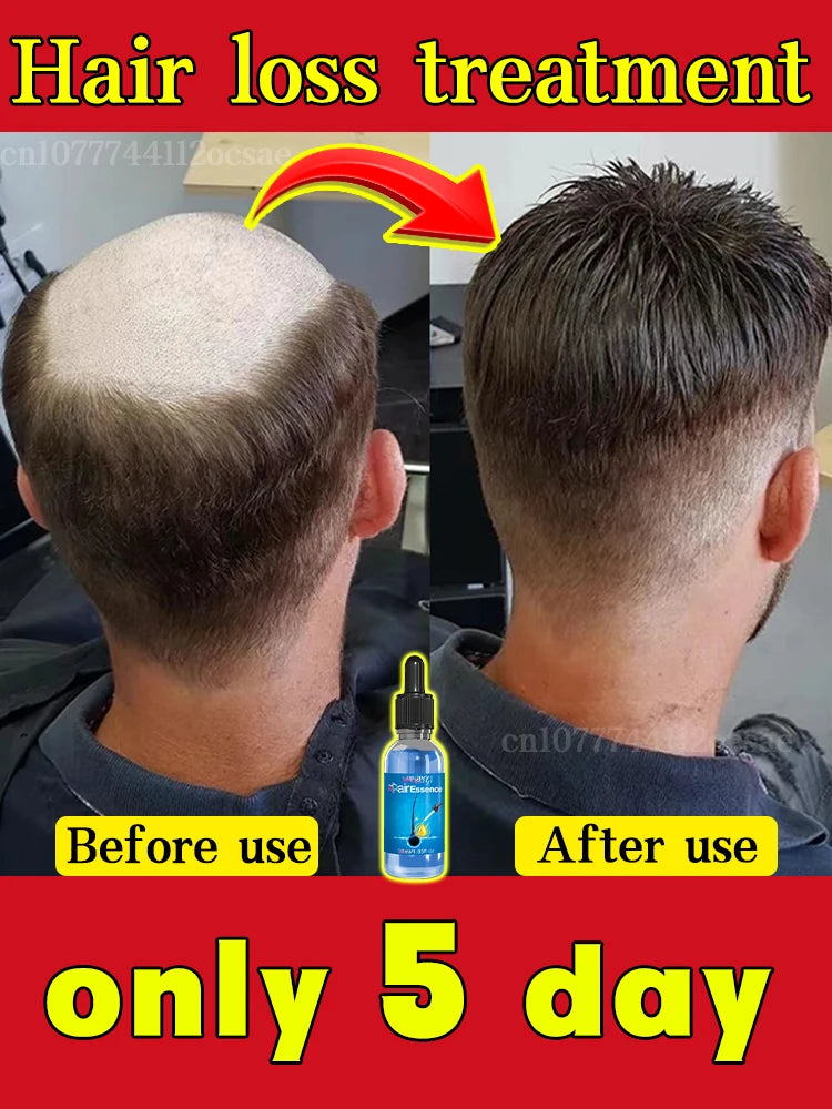 Hair Growth Treatment – Thickening & Anti-Baldness Solution