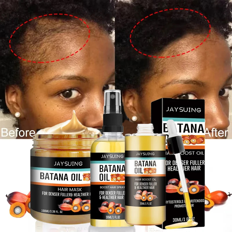 Fast Hair Growth Set – Batana Oil Hair Mask & Growth Oil